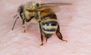 新研究　ミツバチの毒が乳がん細胞を殺すことが明らかに