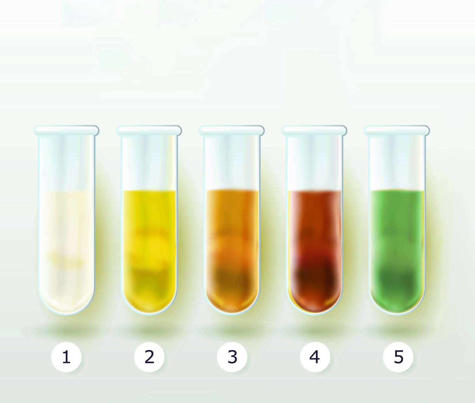Pochi immaginano che il colore dell'urina può rivelare molto sulla tua salute - greenMe