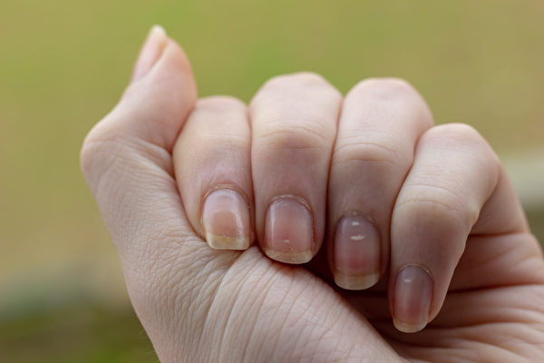 「あなたの爪は健康ですか？」なかには危険なタイプもあります