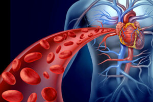 「自然に悪玉コレステロール値を下げる方法」あなたの心臓を守るために（1）
