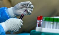 ワクチン未接種者の献血に関する問い合わせが増加、米国の採血事業者が語る