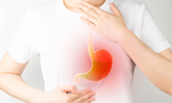 胃がんには多くの誘因がある 胃を守るためのヒント