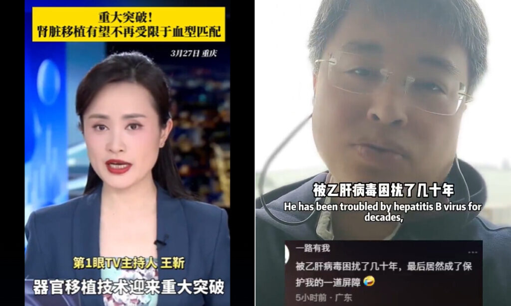 「血液型に関係なく腎移植が可能に」？　 移植技術の誇示に中国市民は戦慄