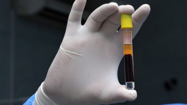 「何を目的に子どもの血を集めるのか」　上海の小学校で採血同意書が波紋