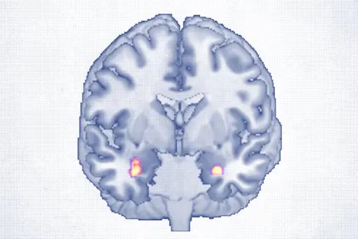 科学が証明：心理療法は脳を再構築し、うつから抜け出す力を与える