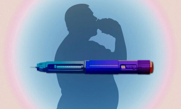 過食タイプが左右する　GLP-1受容体作動薬の効果