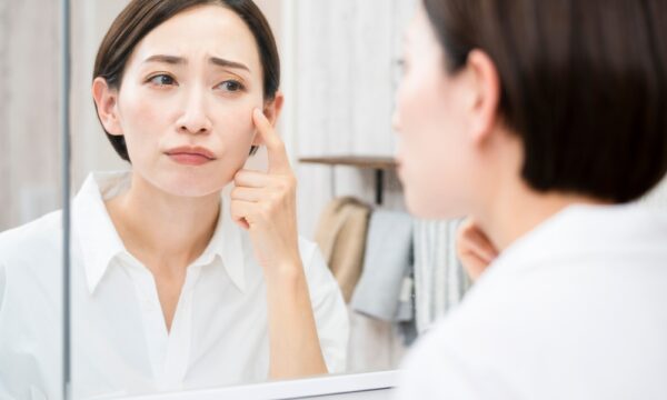 シミは肌だけの問題ではない　内臓の状態を映すサイン