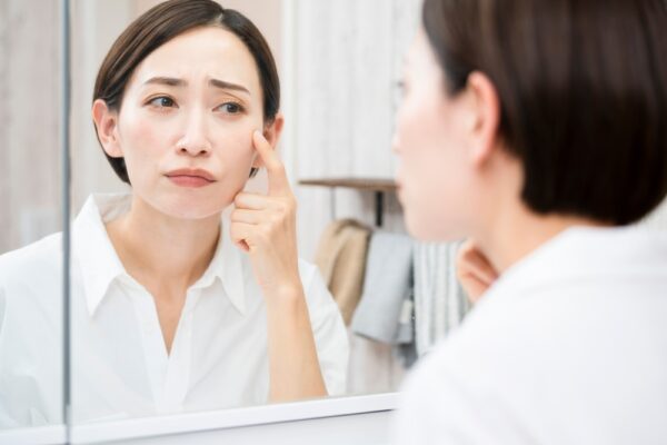 シミは肌だけの問題ではない　内臓の状態を映すサイン