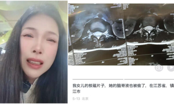 「脳脊髄液を病院に盗まれた」　中国の母親が涙の告発