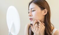思春期を過ぎてもニキビが止まらない？　中医学で見る全身ケア